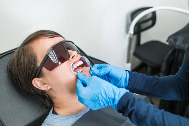 Best Emergency Wisdom Teeth Removal in Moss Beach, CA