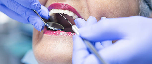 Best Emergency Dental Care for Broken or Chipped Teeth in Moss Beach, CA